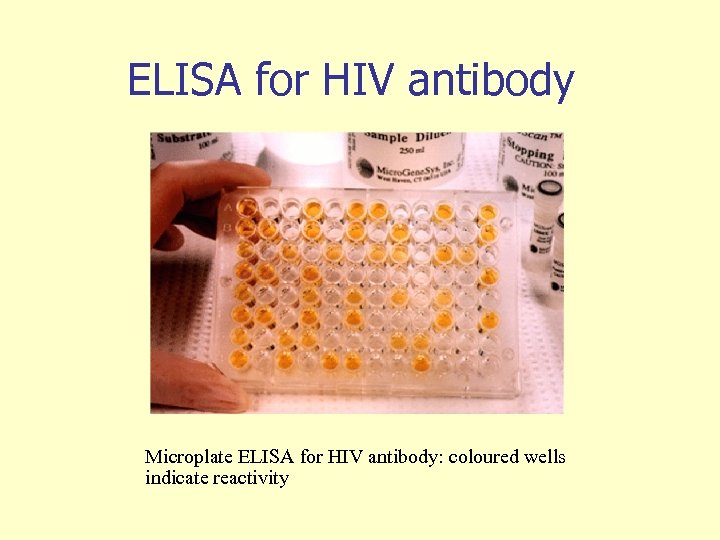 ELISA for HIV antibody Microplate ELISA for HIV antibody: coloured wells indicate reactivity 