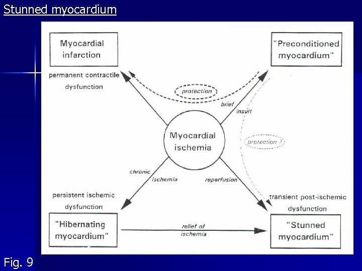 Stunned myocardium Fig. 9 