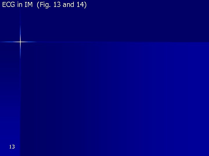 ECG in IM (Fig. 13 and 14) 13 