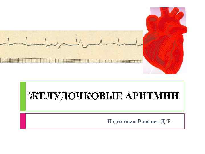 ЖЕЛУДОЧКОВЫЕ АРИТМИИ Подготовил: Волошин Д. Р. 