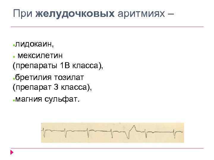 При желудочковых аритмиях – лидокаин, ● мексилетин (препараты 1 В класса), ●бретилия тозилат (препарат