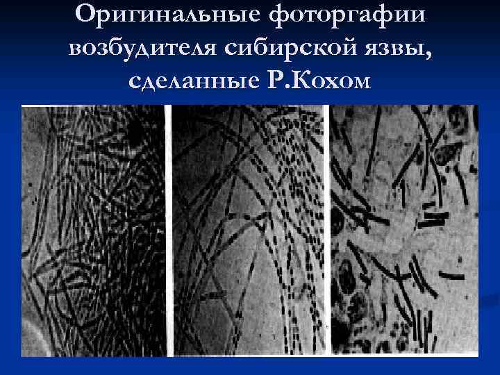 Оригинальные фоторгафии возбудителя сибирской язвы, сделанные Р. Кохом 