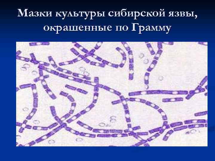 Мазки культуры сибирской язвы, окрашенные по Грамму 