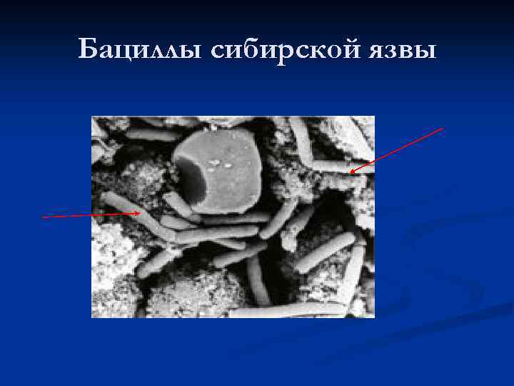 Бациллы сибирской язвы 