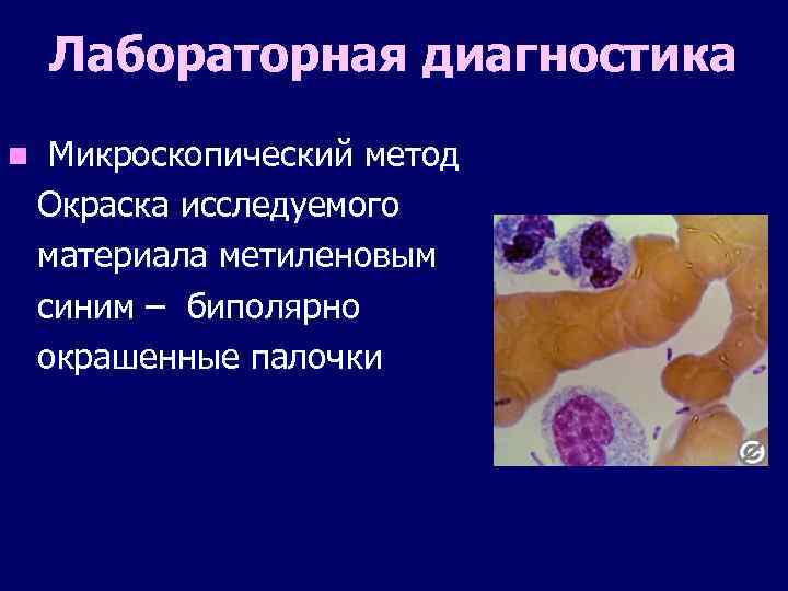 Лабораторная диагностика n Микроскопический метод Окраска исследуемого материала метиленовым синим – биполярно окрашенные палочки