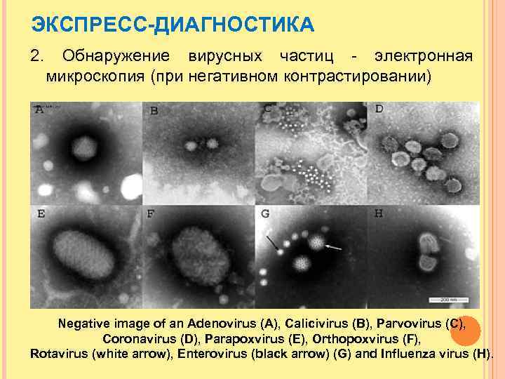 ЭКСПРЕСС-ДИАГНОСТИКА 2. Обнаружение вирусных частиц - электронная микроскопия (при негативном контрастировании) Negative image of