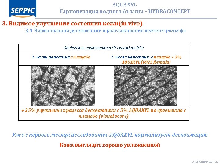 AQUAXYL Гармонизация водного баланса - HYDRACONCEPT 3. Видимое улучшение состояния кожи(in vivo) 3. 1