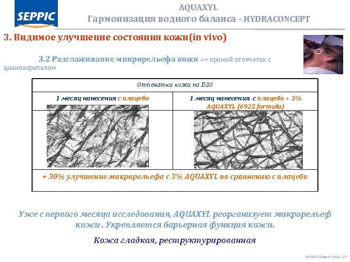 AQUAXYL Гармонизация водного баланса - HYDRACONCEPT 3. Видимое улучшение состояния кожи(in vivo) 3. 2