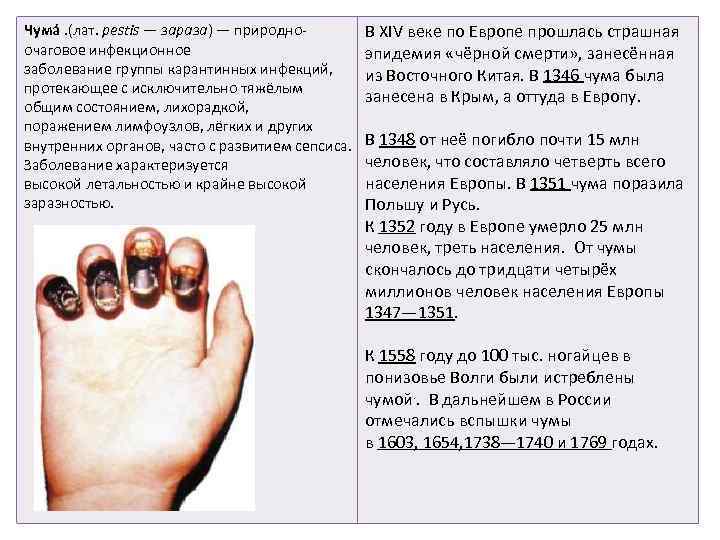 Чума . (лат. pestis — зараза) — природноочаговое инфекционное заболевание группы карантинных инфекций, протекающее