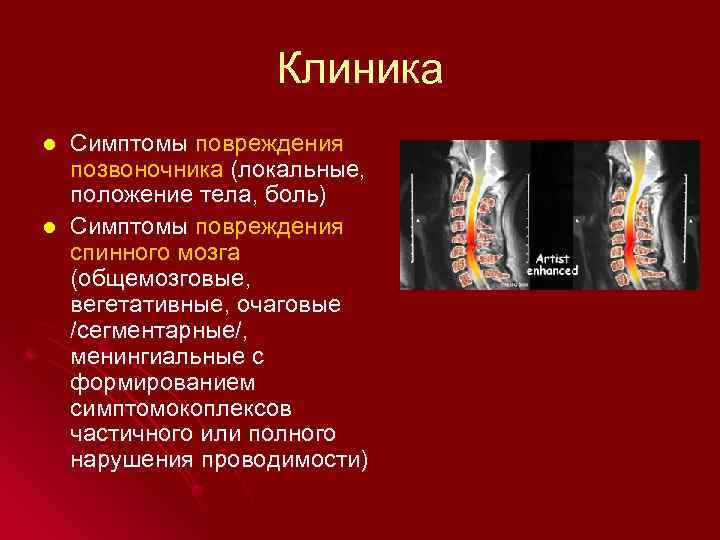 Клиника l l Симптомы повреждения позвоночника (локальные, положение тела, боль) Симптомы повреждения спинного мозга