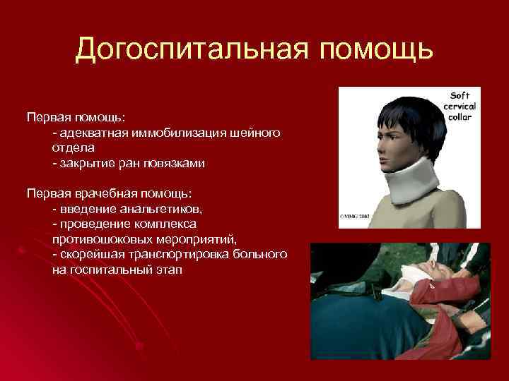 Догоспитальная помощь Первая помощь: - адекватная иммобилизация шейного отдела - закрытие ран повязками Первая