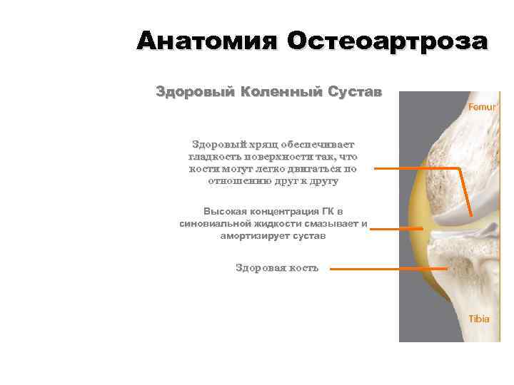 Анатомия Остеоартроза Здоровый Коленный Сустав Здоровый хрящ обеспечивает гладкость поверхности так, что кости могут