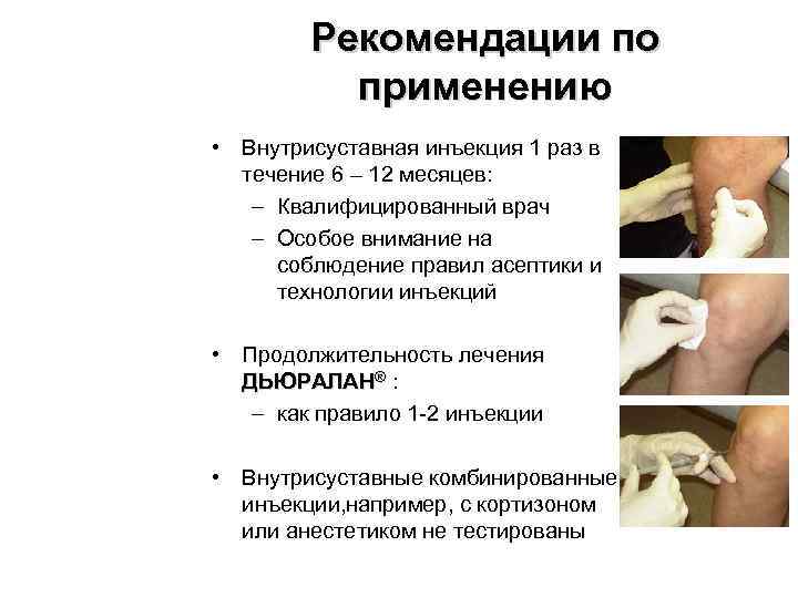 Рекомендации по применению • Внутрисуставная инъекция 1 раз в течение 6 – 12 месяцев: