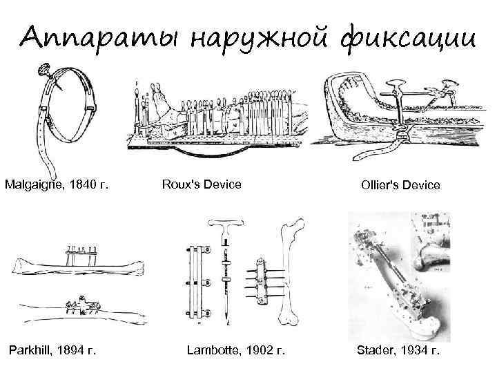 Аппараты наружной фиксации Malgaigne, 1840 г. Parkhill, 1894 г. Roux's Device Lambotte, 1902 г.