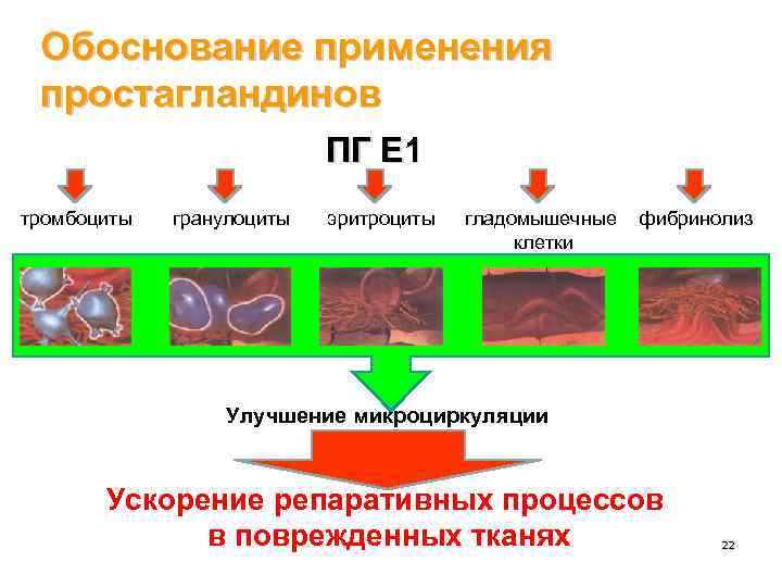 Обоснование применения простагландинов ПГ Е 1 тромбоциты гранулоциты эритроциты гладомышечные клетки фибринолиз Улучшение микроциркуляции