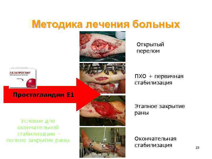 Методика лечения больных Открытый перелом ПХО + первичная стабилизация Простагландин Е 1 Этапное закрытие