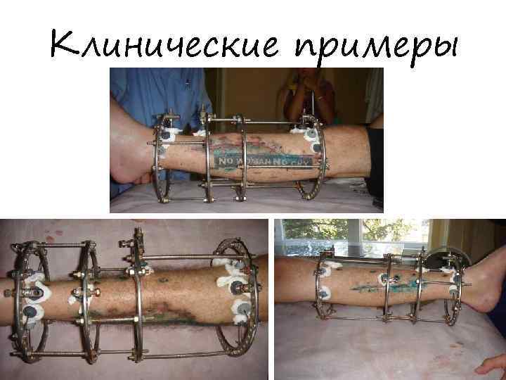 Клинические примеры 