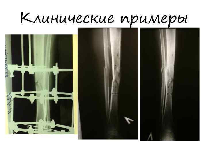 Клинические примеры 