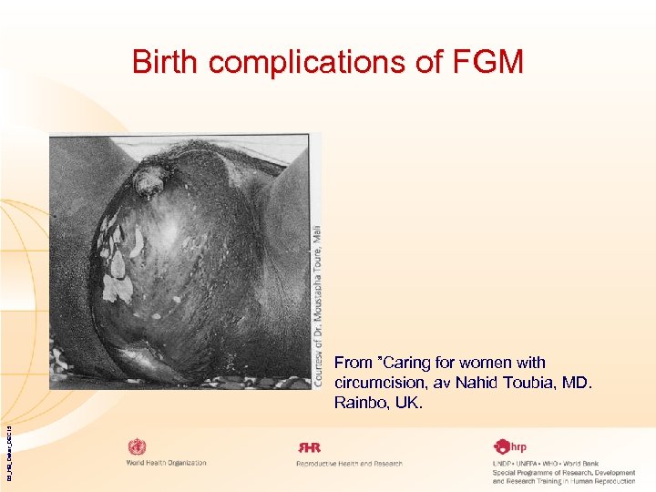 Birth complications of FGM 05_HB_Dakar_DEC 15 From ”Caring for women with circumcision, av Nahid