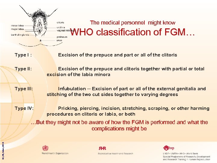 The medical personnel might know WHO classification of FGM… Type I : Excision of