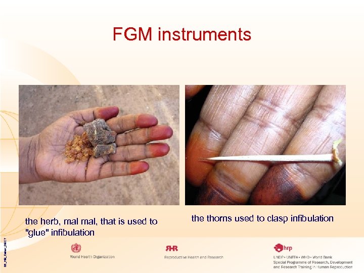 FGM instruments 05_HB_Dakar_DEC 7 the herb, mal, that is used to "glue" infibulation the