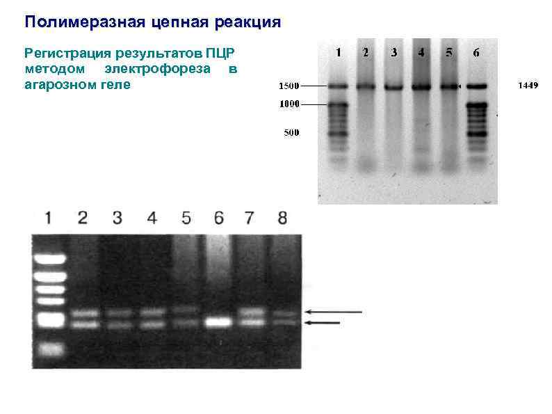 Полимеразная цепная реакция Регистрация результатов ПЦР методом электрофореза в агарозном геле 