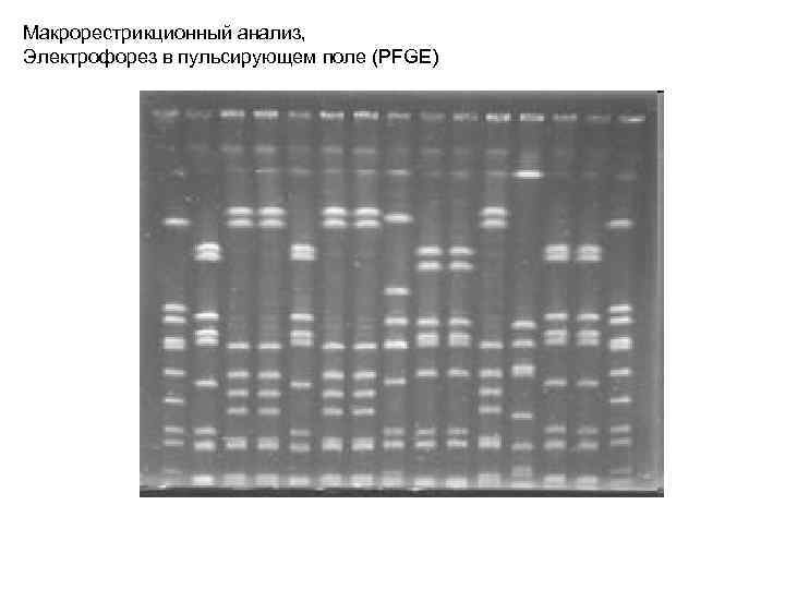 Макрорестрикционный анализ, Электрофорез в пульсирующем поле (PFGE) 