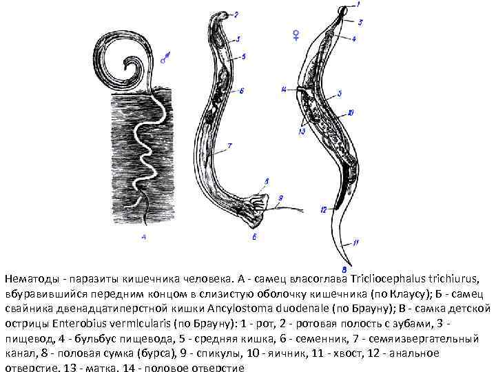 Нематоды - паразиты кишечника человека. А - самец власоглава Tricliocephalus trichiurus, вбуравившийся передним концом