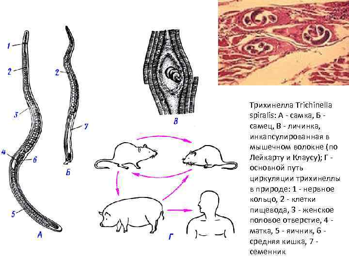 Трихинелла Trichinella spiralis: A - самка, Б самец, В - личинка, инкапсулированная в мышечном