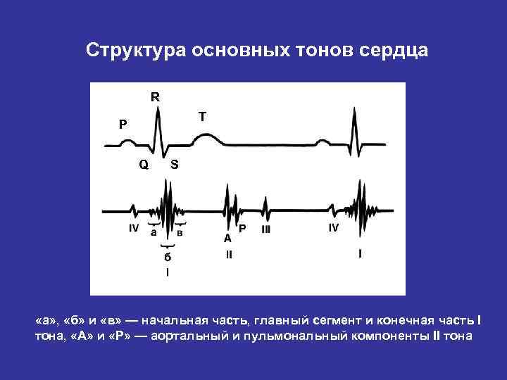 Структура основных тонов сердца R T P Q S «а» , «б» и «в»