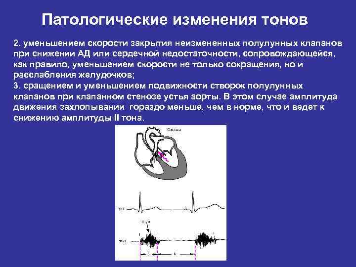 Продолжительность жизни после замены аортального клапана статистика