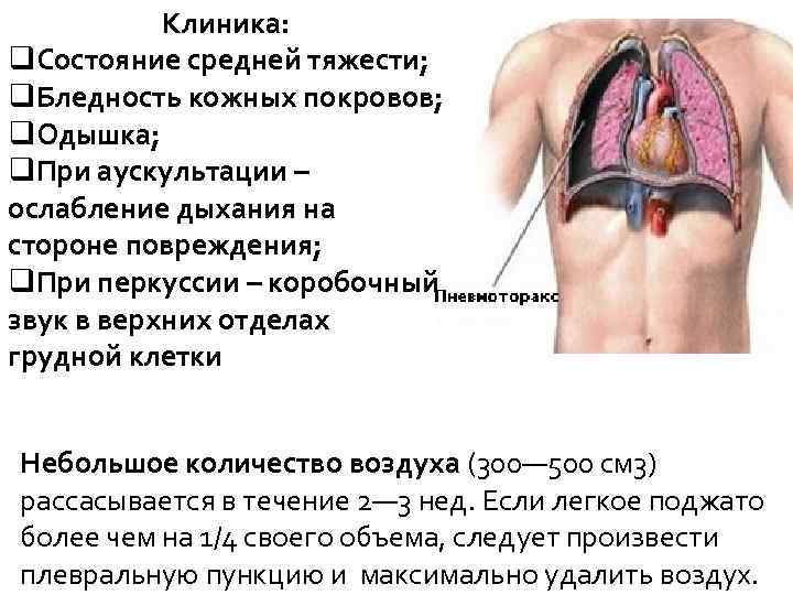 Клиника: q. Состояние средней тяжести; q. Бледность кожных покровов; q. Одышка; q. При аускультации