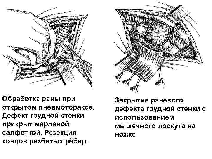 Травматический шок фото