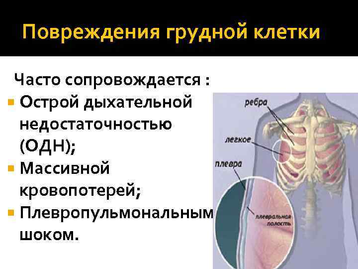 Ответы нмо закрытая травма грудной клетки 2021