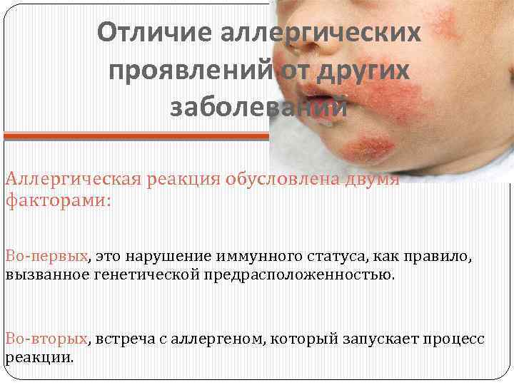 Отличие аллергических проявлений от других заболеваний Аллергическая реакция обусловлена двумя факторами: Во-первых, это нарушение