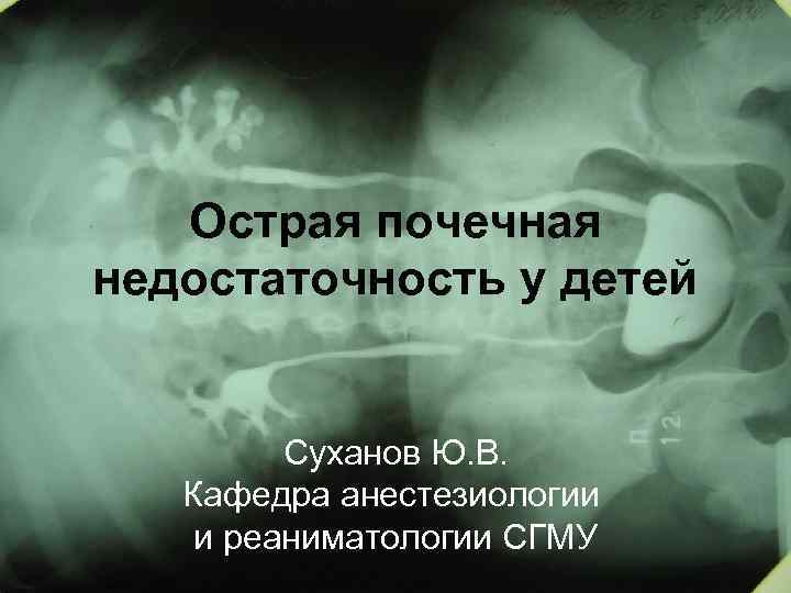 Острая почечная недостаточность у детей Суханов Ю. В. Кафедра анестезиологии и реаниматологии СГМУ 