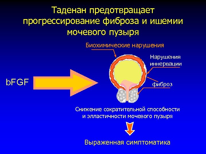 Таденан предотвращает прогрессирование фиброза и ишемии мочевого пузыря Биохимические нарушения Нарушения иннервации b. FGF