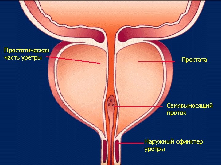 Простатическая часть уретры Простата Семявыносящий проток Наружный сфинктер уретры 