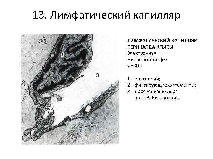 Лимфатические капилляры. Лимфатические сосуды гистология. Лимфатические капилляры микрофотографии. Лимфатический капилляр гистология. Лимфатический капилляр Электронограмма.