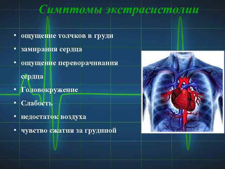 Симптомы экстрасистолии • ощущение толчков в груди • замирания сердца • ощущение переворачивания сердца
