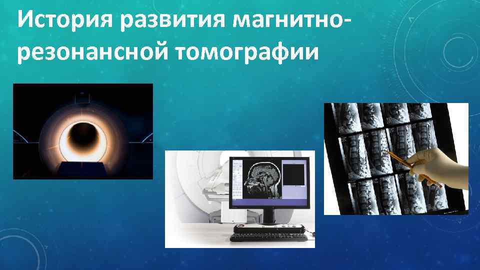 История развития магнитнорезонансной томографии 