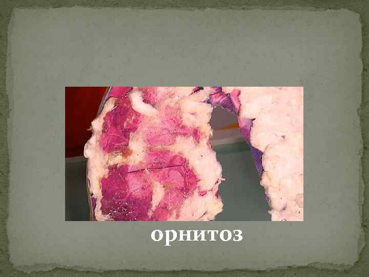 орнитоз 