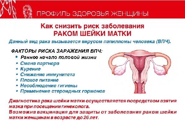 ПРОФИЛЬ ЗДОРОВЬЯ ЖЕНЩИНЫ Как снизить риск заболевания РАКОМ ШЕЙКИ МАТКИ Данный вид рака вызывается