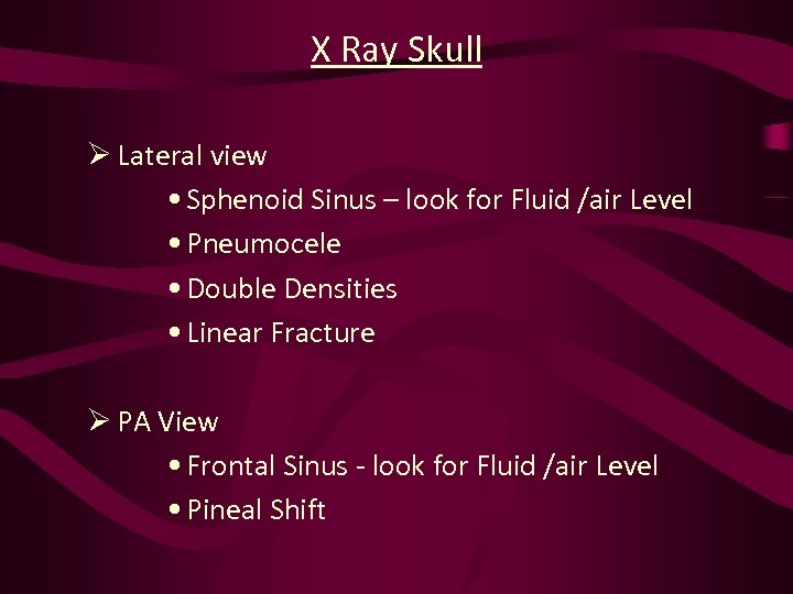 X Ray Skull Ø Lateral view • Sphenoid Sinus – look for Fluid /air