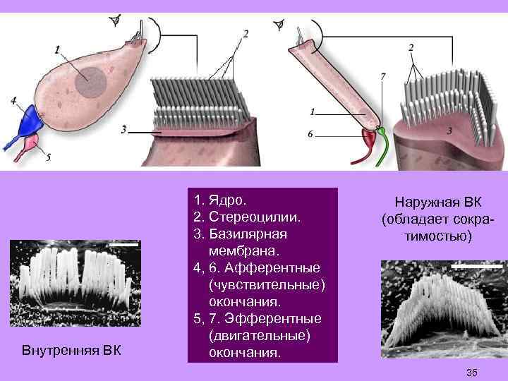 Внутренняя ВК 1. Ядро. 2. Стереоцилии. 3. Базилярная мембрана. 4, 6. Афферентные (чувствительные) окончания.