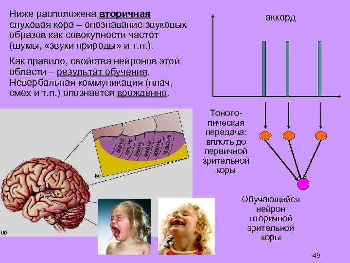 Ниже расположена вторичная слуховая кора – опознавание звуковых образов как совокупности частот (шумы, «звуки