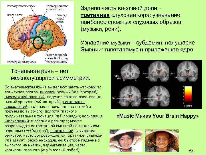 Задняя часть височной доли – третичная слуховая кора: узнавание наиболее сложных слуховых образов (музыки,