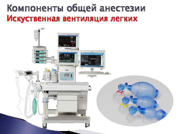 Компоненты общей анестезии Искуственная вентиляция легких 