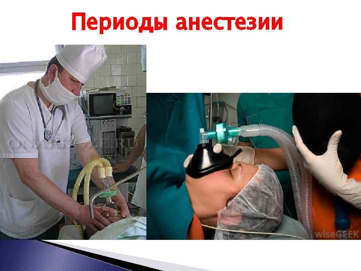 Периоды анестезии 