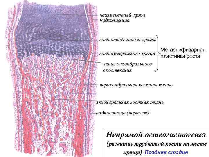 неизмененный хрящ надхрящница зона столбчатого хряща зона пузырчатого хряща Метаэпифизарная пластинка роста линия энхондрального